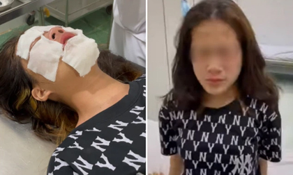 Hải Phòng: Chọc ghẹo không thành, nam thanh niên cay cú hành hung, xịt hơi cay vào mặt nữ sinh rồi bỏ đi