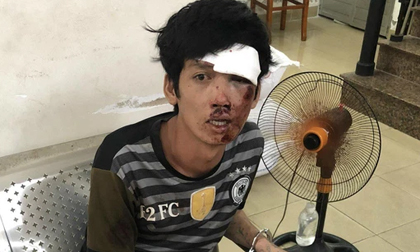 TP.HCM: Đẩy bạn xuống kênh để cướp tài sản, gã thanh niên tông vào con lươn bất tỉnh