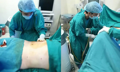 Một phụ nữ 50 tuổi tử vong sau khi hút mỡ bụng 3 ngày