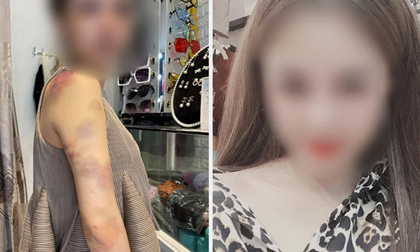 Bị tố bạo hành vợ xuyên đêm ở Yên Bái, người chồng lên tiếng: Có tát, đấm vào đầu, vai nhưng không đánh, nhốt