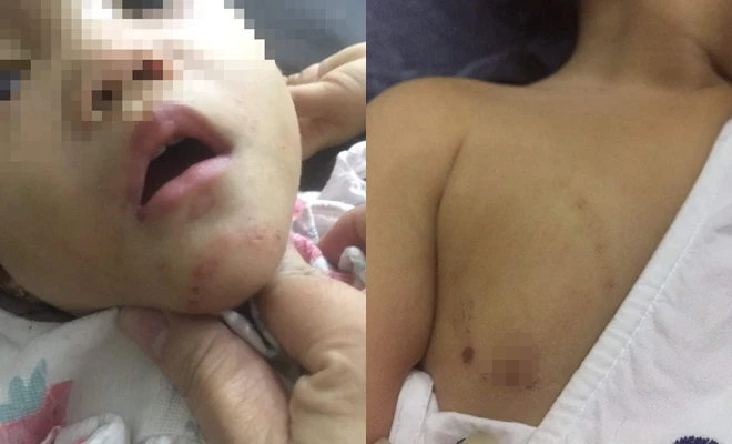 Mẹ nuôi bé 16 tháng tuổi nghi bị bạo hành: Người làm mẹ đứng giữa như tôi rất khổ tâm - Ảnh 1.