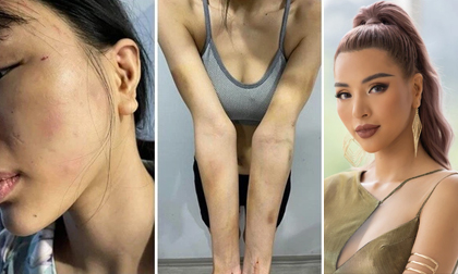 Siêu mẫu Khả Trang công bố quá trình được mẹ đẻ và công an giải cứu sau 2 ngày bị giam lỏng hành hung