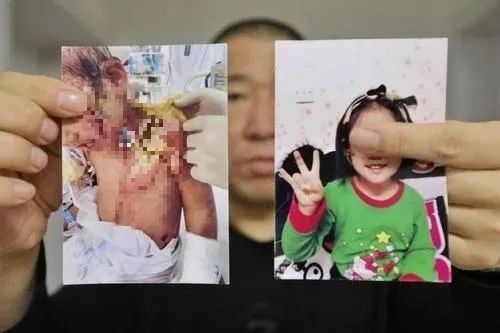 Mẹ hùa theo nhân tình bạo hành man rợ con gái : Găm kim vào đùi, giội nước sôi vào đầu  - Ảnh 2.