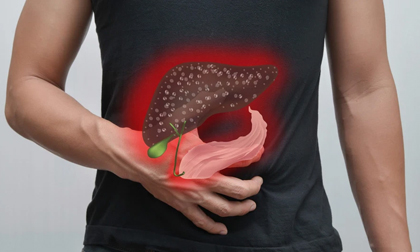 Sau Tết, gan dễ bị tổn thương, gây bệnh nguy hiểm: Dấu hiệu cảnh báo sớm cần đi khám ngay