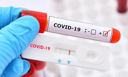 Một doanh nghiệp ở Hà Nội chi hàng nghìn tỷ nhập khẩu kit test Covid-19, khủng hơn Việt Á