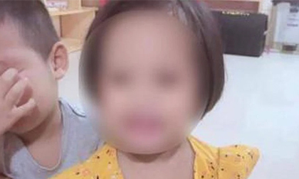 Nóng: Bé gái 3 tuổi bị đinh găm vào đầu đã tử vong sau gần 2 tháng điều trị