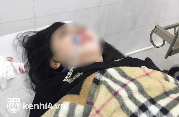 Cô gái 22 tuổi tử vong sau 2 tháng hôn mê khi đi phẫu thuật thẩm mỹ: Gia đình tốn hàng trăm triệu nhưng không cứu được nạn nhân - Ảnh 1.