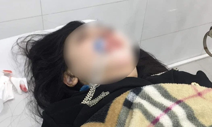 Cô gái 22 tuổi tử vong sau 2 tháng hôn mê khi đi phẫu thuật thẩm mỹ: Gia đình tốn hàng trăm triệu nhưng không cứu được nạn nhân