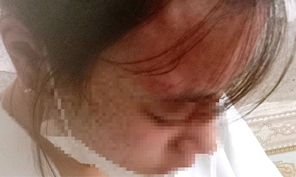 Đến quán tạp hóa mua kim khâu, nữ sinh lớp 10 bị chủ quán đánh đập dã man