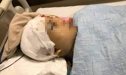 Tạm giữ 2 đối tượng đánh Phó Chủ tịch xã vỡ hộp sọ ở Hải Dương