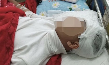 Mâu thuẫn trên lớp, ra về rủ bạn chặn đường đánh vỡ đầu lớp trưởng