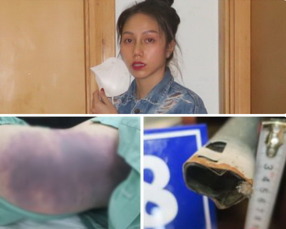 Vụ bé gái 8 tuổi bị dì ghẻ bạo hành: Đề nghị triệu tập bà nội bé gái và 5 người khác tới tòa - Ảnh 1. Vụ bé gái 8 tuổi bị dì ghẻ bạo hành: Đề nghị triệu tập bà nội bé gái và 5 người khác tới tòa - Ảnh 1.