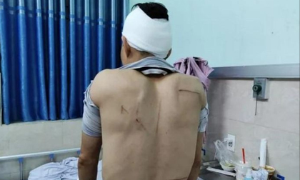 Những vụ côn đồ truy sát người dân gây phẫn nộ thời gian qua