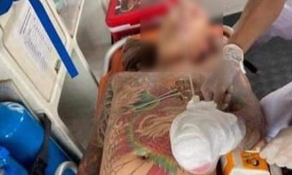 Điều tra nguyên nhân nam thanh niên bị chém lìa bàn tay khi đang cắt tóc