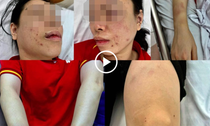 Nghi án người phụ nữ bị chồng cũ đánh đập, dã man