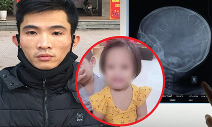 Xét xử kẻ bạo hành, đóng đinh vào đầu cháu bé 3 tuổi