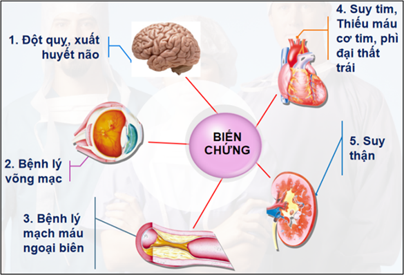 Thời tiết lạnh, người bệnh tăng huyết áp phải nhớ hạn chế những thực phẩm này để phòng ngừa biến chứng - Ảnh 2.