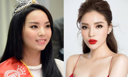 Dàn Hậu Việt liên tục bị nghi phẫu thuật thẩm mỹ: Người thừa nhận, người khẳng định đẹp tự nhiên