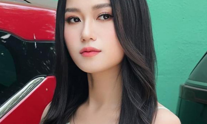 Lâm Vỹ Dạ khiến dân tình hoang mang với gương mặt 'xinh đẹp bất thường', nghi vấn đã 'dao kéo'