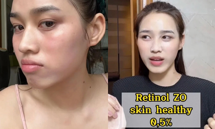 Hoa hậu Đỗ Thị Hà chăm da cực khéo nhưng vẫn gặp phải sự cố với 'thần dược' làm đẹp da này