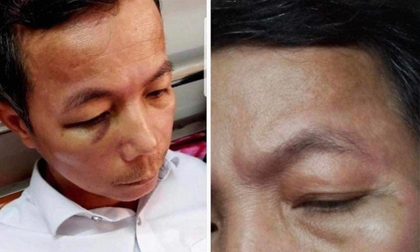 Xử phạt vi phạm hành chính 'hiệu trưởng đánh hiệu phó nhập viện'
