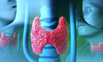 Không muốn u tuyến giáp phát triển nhất định đừng ăn nhiều 3 món này