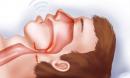 Bác sĩ tim mạch: Tiếng ngáy khi ngủ phản ánh tình trạng sức khỏe không thể bỏ qua
