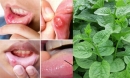 Ăn 5 loại rau ăn vào mùa hè được ví như 'thuốc mát gan' tự nhiên không lo nóng trong, lở miệng 