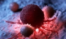 Đột phá về ung thư: Các nhà khoa học khám phá các tế bào T mới có tiềm năng loại bỏ ung thư