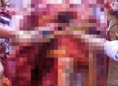 bi-dam-trong-thuong-bac-si-chi-khau-roi-cho-ve-121203.html