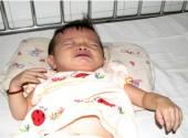 be-gai-hon-1-tuoi-bi-benh-tim-nam-thoi-thop-vi-thieu-tien-phau-thuat-148154.html