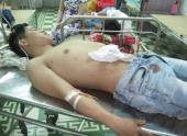 nam-thanh-nien-bi-dam-trong-thuong-khi-di-choi-tet-127219.html