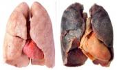 uong-coc-nuoc-nay-vao-hut-thuoc-la-lau-nam-co-nao-phoi-cung-duoc-thanh-loc-278461.html