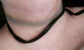 tam-giu-hinh-su-con-trai-9x-dung-that-lung-siet-co-me-den-chet-322665.html