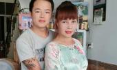 co-dau-63-tuoi-o-cao-bang-sau-2-thang-phau-thuat-cang-da-mat-dien-mao-khien-ai-cung-dong-y-la-dao-keo-hong-360922.html