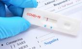 bien-the-omicron-co-tang-hinh-voi-test-nhanh-covid-19-381789.html