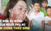 nguoi-phu-nu-bi-chong-tuoi-xang-thieu-song-bong-92-3-nam-qua-giong-nhu-mot-con-ac-mong-em-dau-lam-nhung-phai-song-vi-con-382959.html