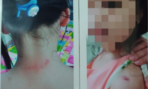Diễn biến mới vụ ông bà nội cầu cứu vì 2 cháu gái nghi bị cha dượng bạo hành ở Hà Nội