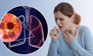 Người phụ nữ 35 tuổi mất 2 năm mới biết mình bị ung thư phổi vì các triệu chứng bị nhầm lẫn là do căng thẳng