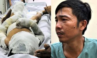 Cha bé trai bị dì tưới xăng: 'Sao nó ác thế' Cha bé trai bị dì tưới xăng: 'Sao nó ác thế'