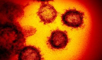 Tại sao virus corona không sống nhưng rất khó tiêu diệt? Tại sao virus corona không sống nhưng rất khó tiêu diệt?