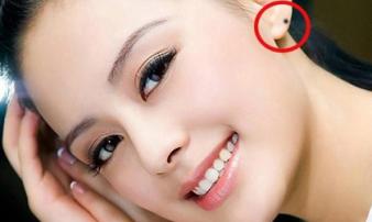 4 nốt ruồi ở tai phụ nữ quý như kim cương, gia chủ cả đời an nhàn sung sướng 4 nốt ruồi ở tai phụ nữ quý như kim cương, gia chủ cả đời an nhàn sung sướng