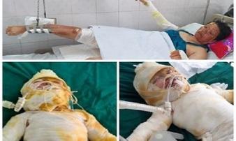 Chồng chết, vợ con nguy kịch vì chập điện cháy điều hòa Chồng chết, vợ con nguy kịch vì chập điện cháy điều hòa