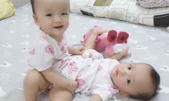 Hành trình sống kỳ diệu của cặp song sinh bị dính liền nhau ở vùng bụng Hành trình sống kỳ diệu của cặp song sinh bị dính liền nhau ở vùng bụng