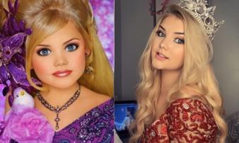 Hoa hậu nhí nước Mỹ bị 'chín ép' một thời: Tiêm botox và ăn kiêng mỗi ngày, sau 9 năm từ nhan sắc đến cuộc sống đều gây bất ngờ Hoa hậu nhí nước Mỹ bị 'chín ép' một thời: Tiêm botox và ăn kiêng mỗi ngày, sau 9 năm từ nhan sắc đến cuộc sống đều gây bất ngờ