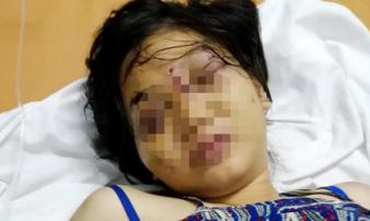 Truy tố 3 người tra tấn cô gái ở TP.HCM đến sẩy thai Truy tố 3 người tra tấn cô gái ở TP.HCM đến sẩy thai