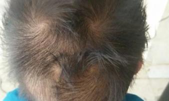 Nhìn xoáy tóc của trẻ biết vận mệnh tương lai, con bạn có mấy xoáy? Nhìn xoáy tóc của trẻ biết vận mệnh tương lai, con bạn có mấy xoáy?