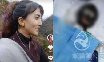 Bị thiêu sống ngay trên sóng livestream, nữ streamer nhận được nghĩa cử ấm lòng của dân mạng Bị thiêu sống ngay trên sóng livestream, nữ streamer nhận được nghĩa cử ấm lòng của dân mạng