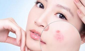 5 dấu hiệu chứng tỏ cơ thể bạn đang thiếu vitamin, canxi trầm trọng, cần bổ sung ngay 5 dấu hiệu chứng tỏ cơ thể bạn đang thiếu vitamin, canxi trầm trọng, cần bổ sung ngay