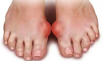 Nhìn xuống bàn chân thấy 6 dấu hiệu này cần đi khám ngay, đừng để lâu mà hối không kịp Nhìn xuống bàn chân thấy 6 dấu hiệu này cần đi khám ngay, đừng để lâu mà hối không kịp